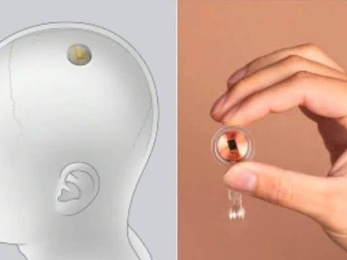 Telephaty, the chip that makes Musk's company "speak with your mind".