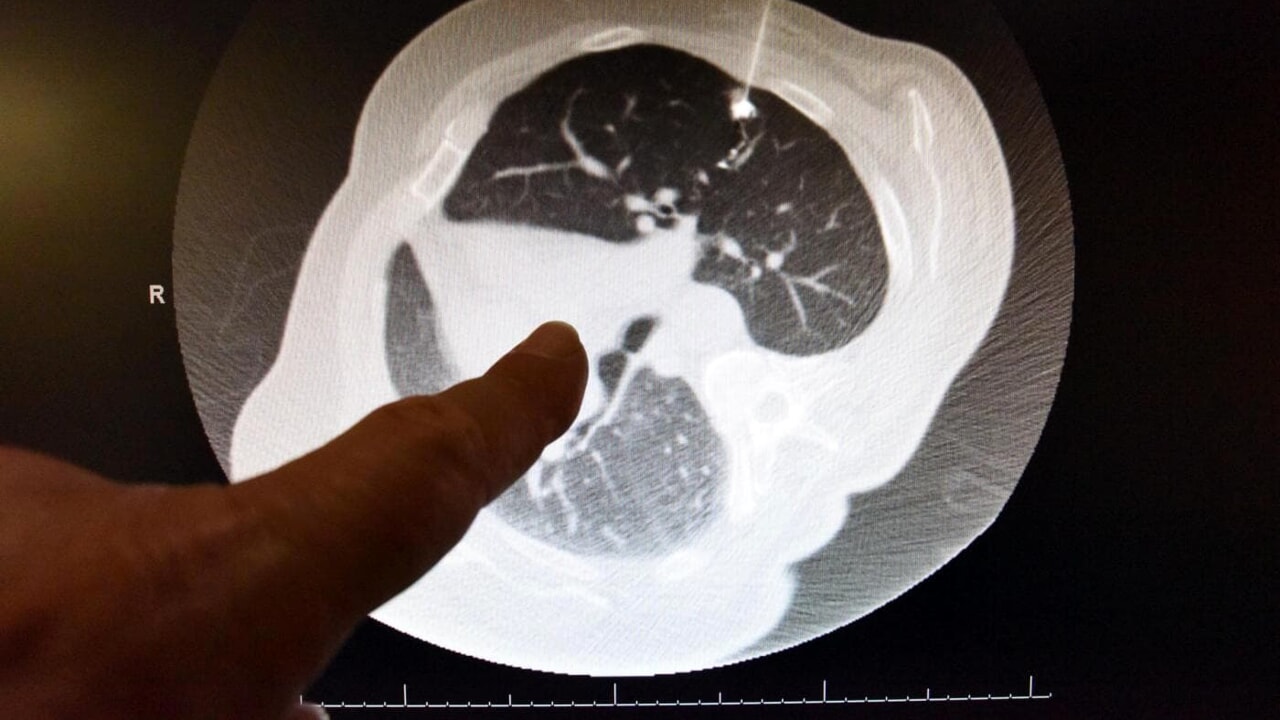 Sotorasib, the drug that can cure cancer stopped by bureaucracy