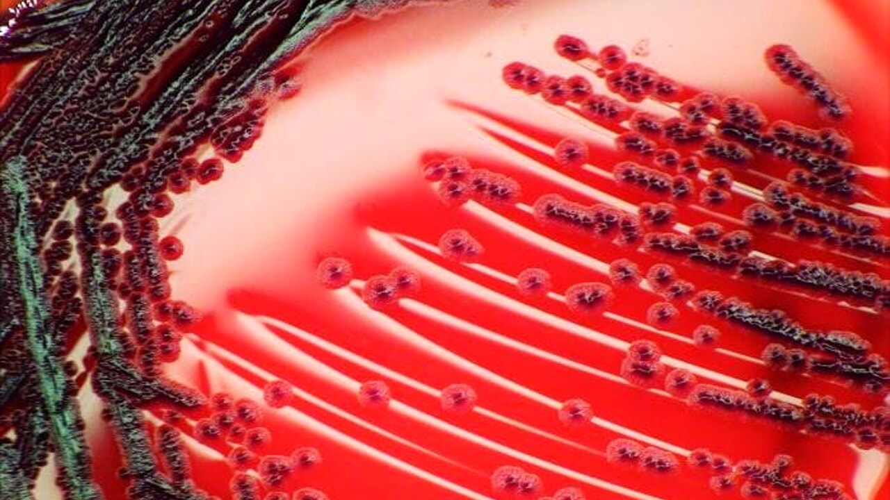 What is flesh-eating toxic shock syndrome?
