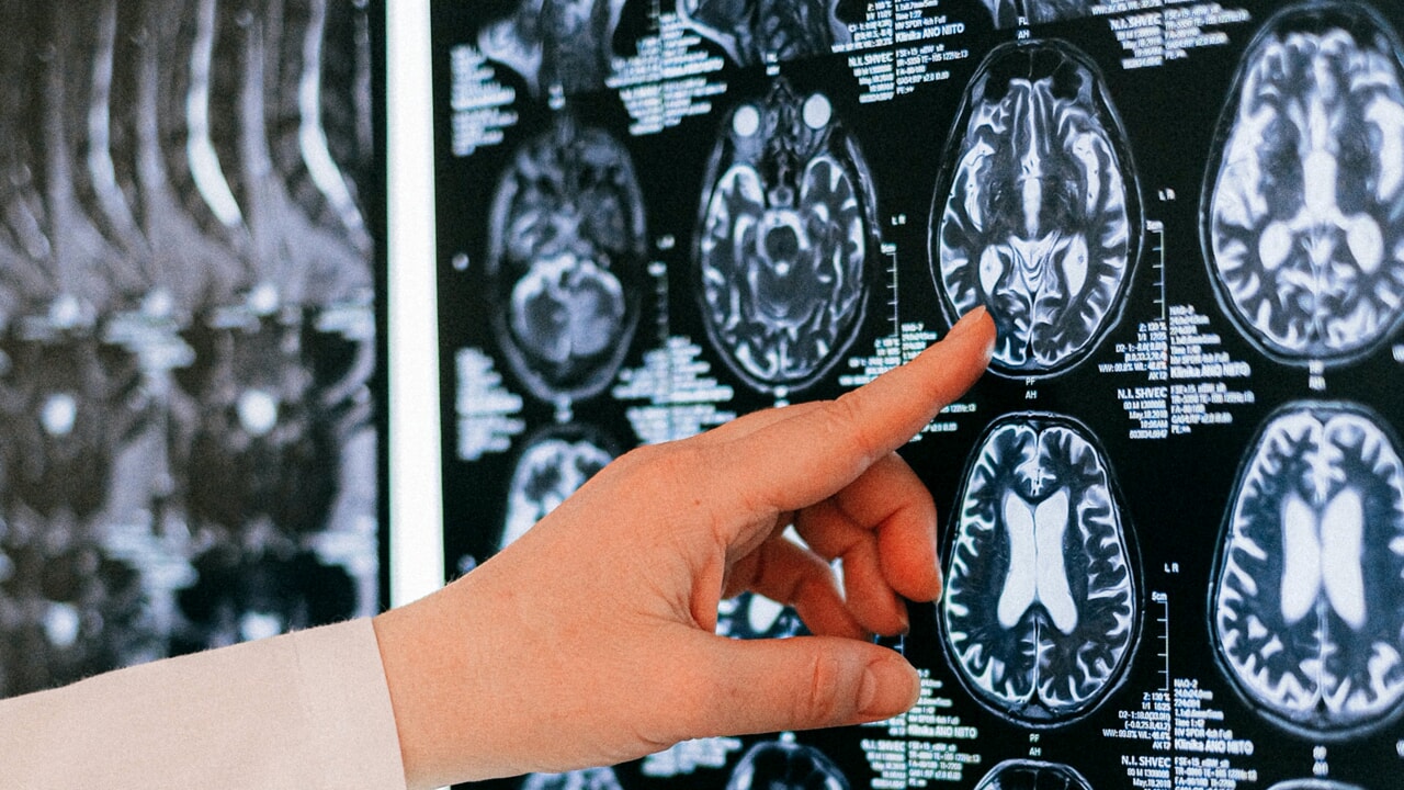 So "stomach ache" can have repercussions on the brain