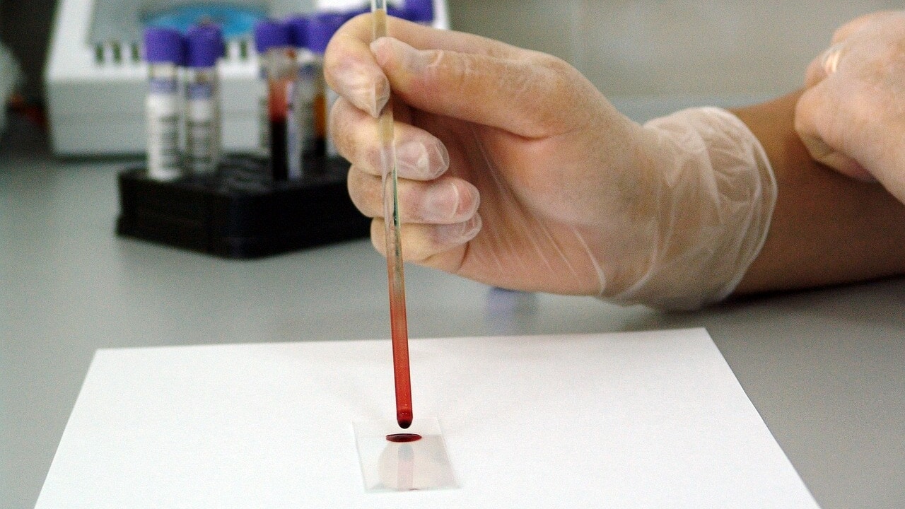 We capture tumor cells circulating in the blood: this is how we can "predict" cancer