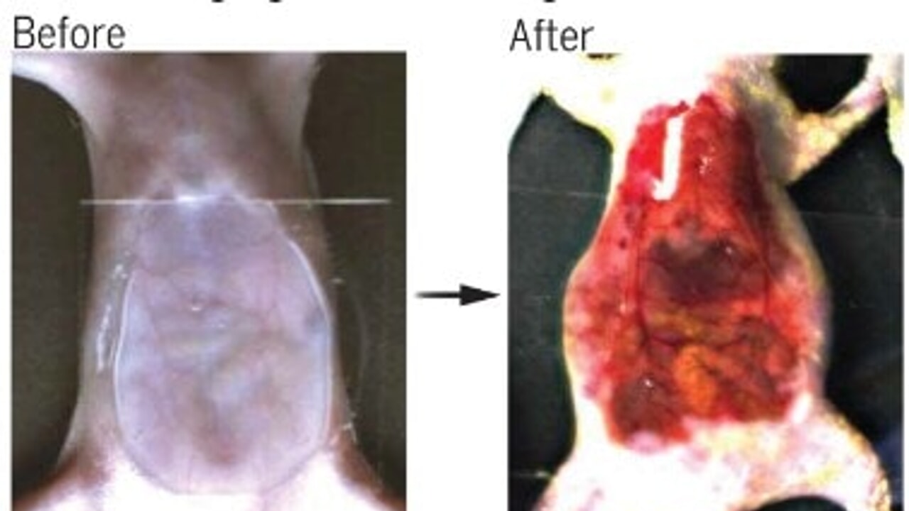 The dye that makes skin invisible