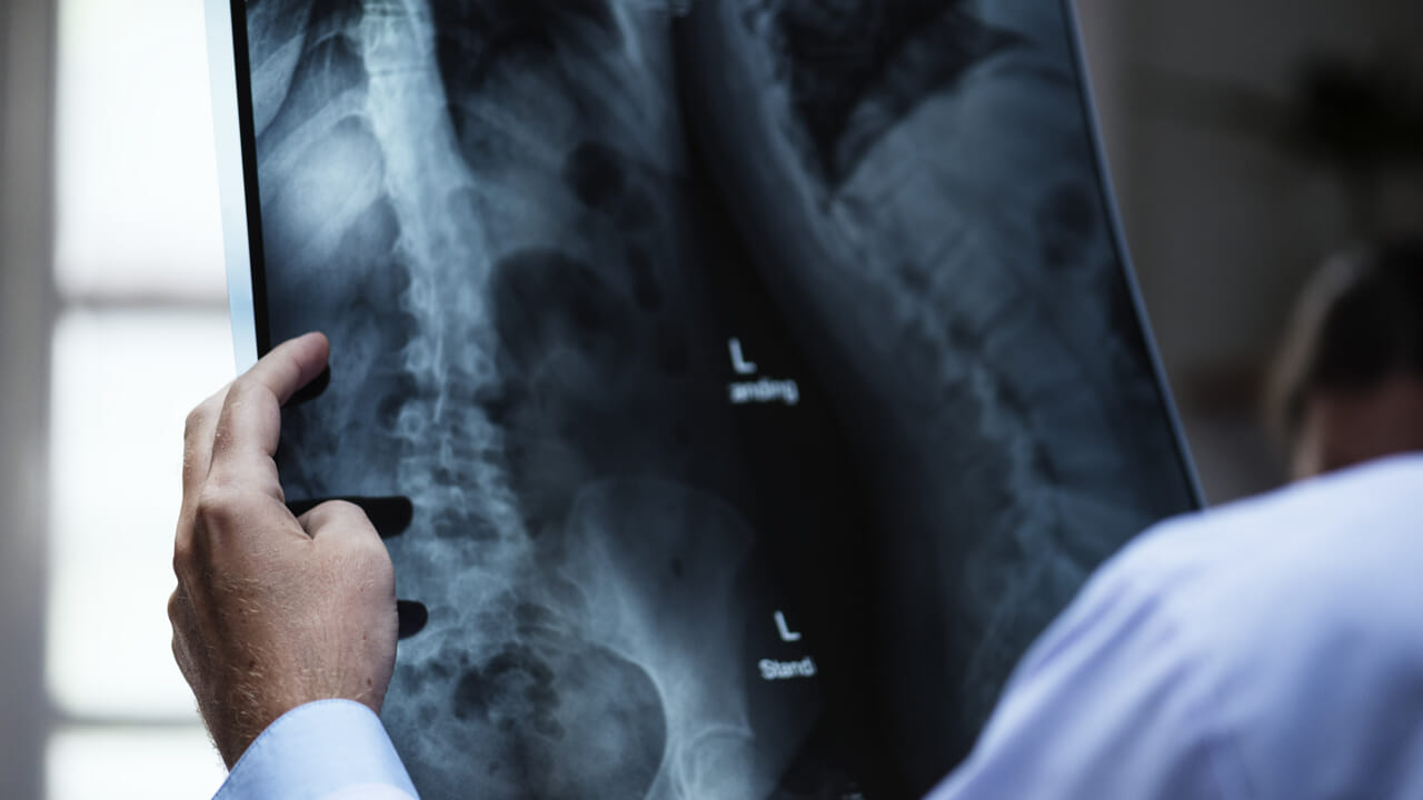 Now artificial intelligence discovers tumors and recommends treatments