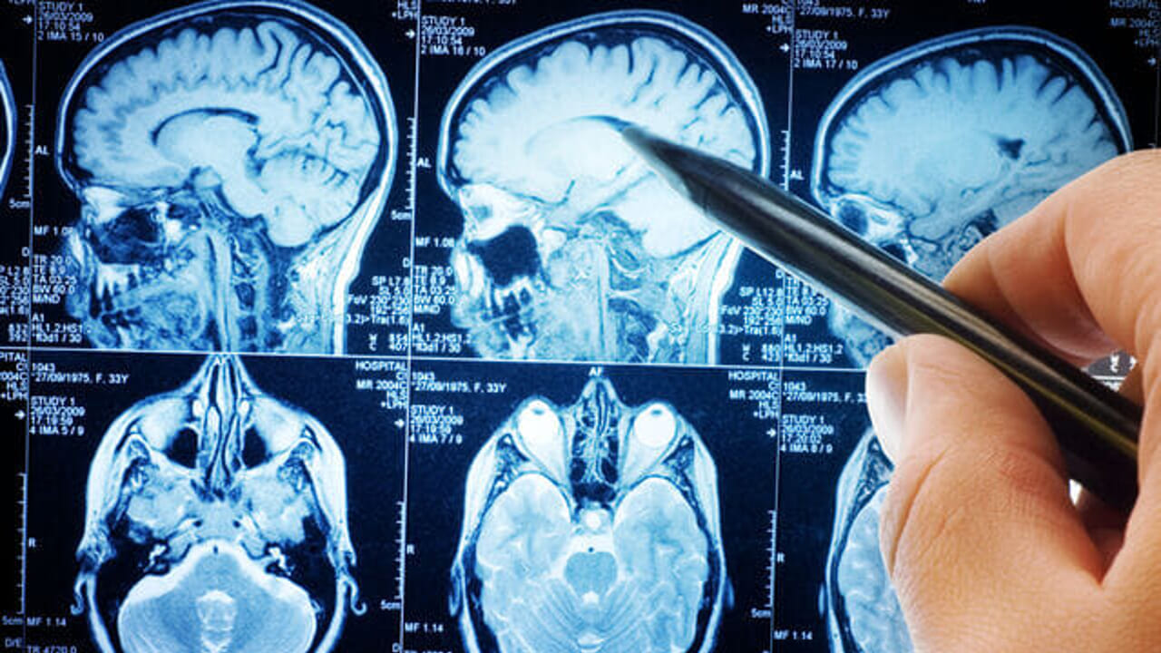 Actually the brain of people with ADHD is made in a different way