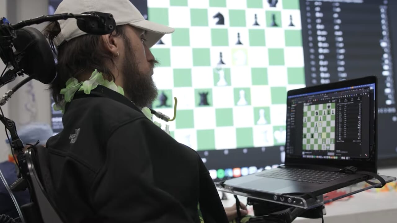 Telepathy is (almost) reality: how Elon Musk's brain chip tests are going