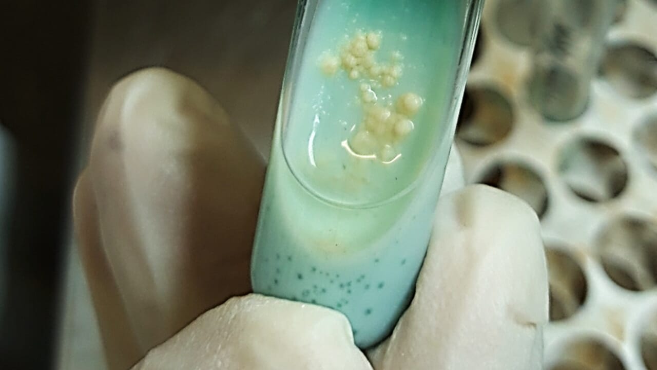 They invented a "universal" spray vaccine (also prevents allergies)