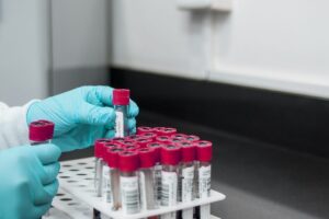Beta-thalassemia, why Italy must change course (and quickly)