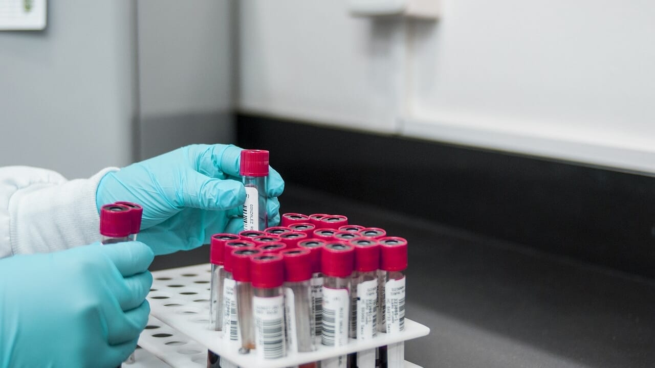 A three-drug combination managed to completely eliminate pancreatic cancer in mice