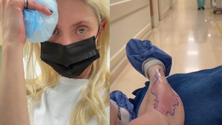Bitten by a poisonous spider, Gossip Girl actress Taylor Momsen in hospital: "It took off a piece of my flesh"