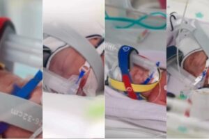 The woman who gave birth to identical quadruplets