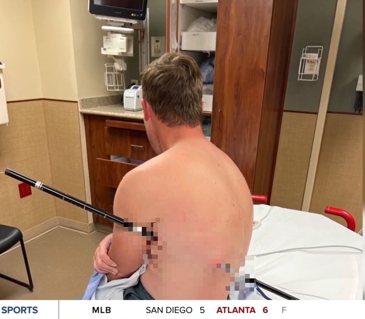 David Cifaldi in hospital with his trekking pole still stuck in his side david cifaldi trekking stick alongside ktvq