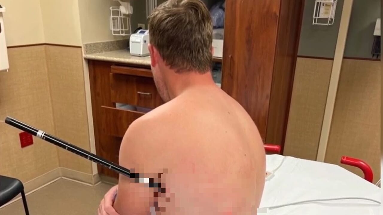 Hiker walks for six hours with a trekking pole in his side: he wanted to save on rescue costs