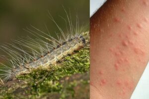 The caterpillar with 800 thousand stinging hairs is multiplying thanks to the record heat
