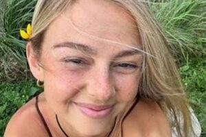 The 26-year-old girl who talked about her rare tumor on social media has died