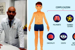 Measles, there is a new alarm: why the virus strikes again and what we risk
