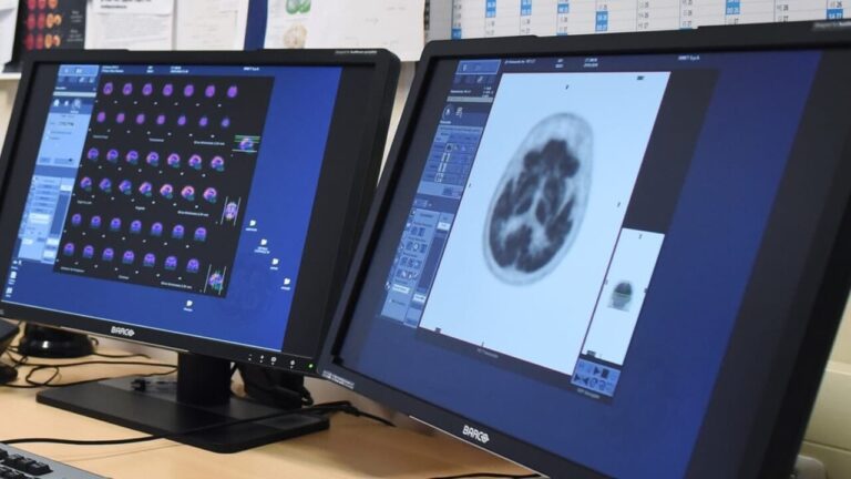 The woman who underwent 11 years of chemotherapy for a tumor that wasn't there