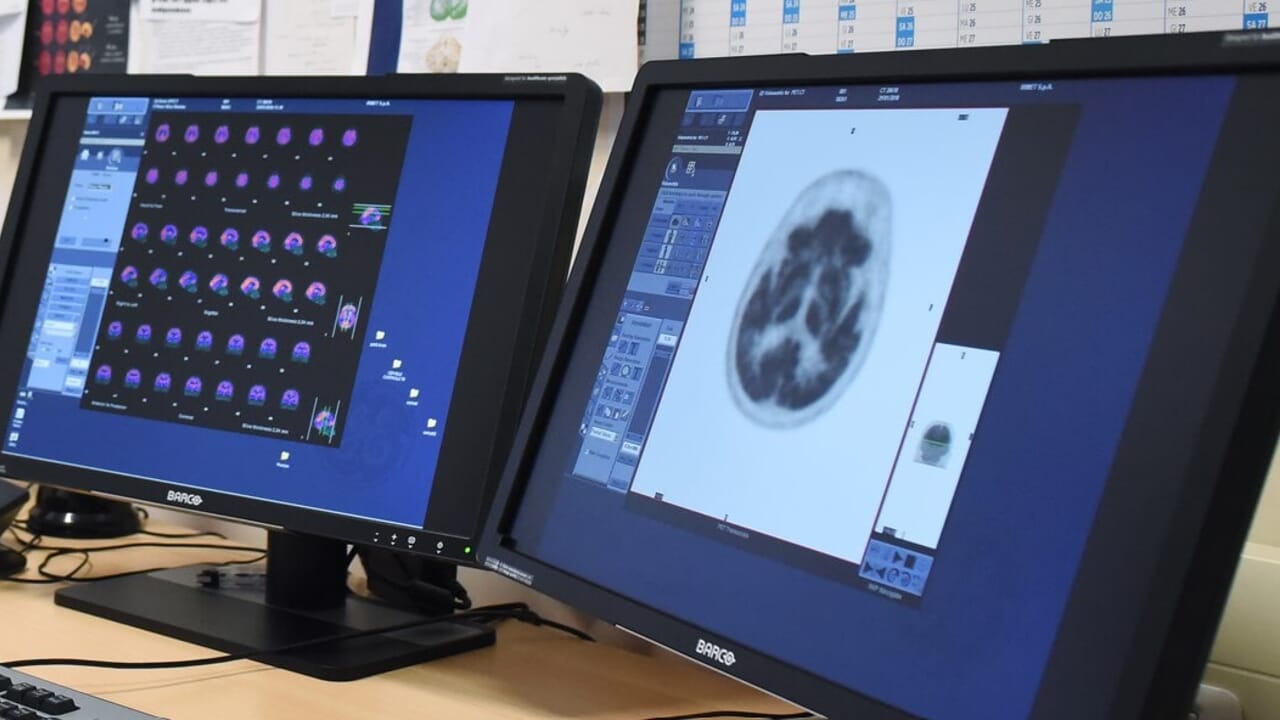 The woman who underwent 11 years of chemotherapy for a tumor that wasn't there