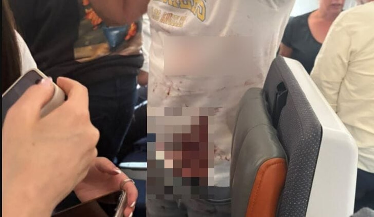 One of the passengers covered in blood (X/Amichai Stein) injured-passenger-flight-flydubai-x_censored