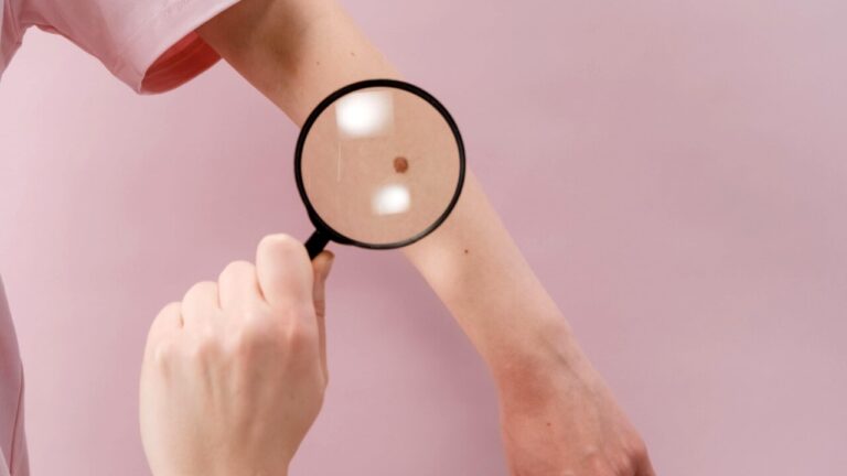 Personalized melanoma vaccine works, but costs millions for each individual patient