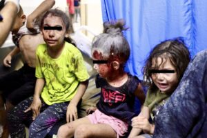 "His brain is protected only by his skin": what Ismail, the Naza child who is waiting to be operated on in Italy, says