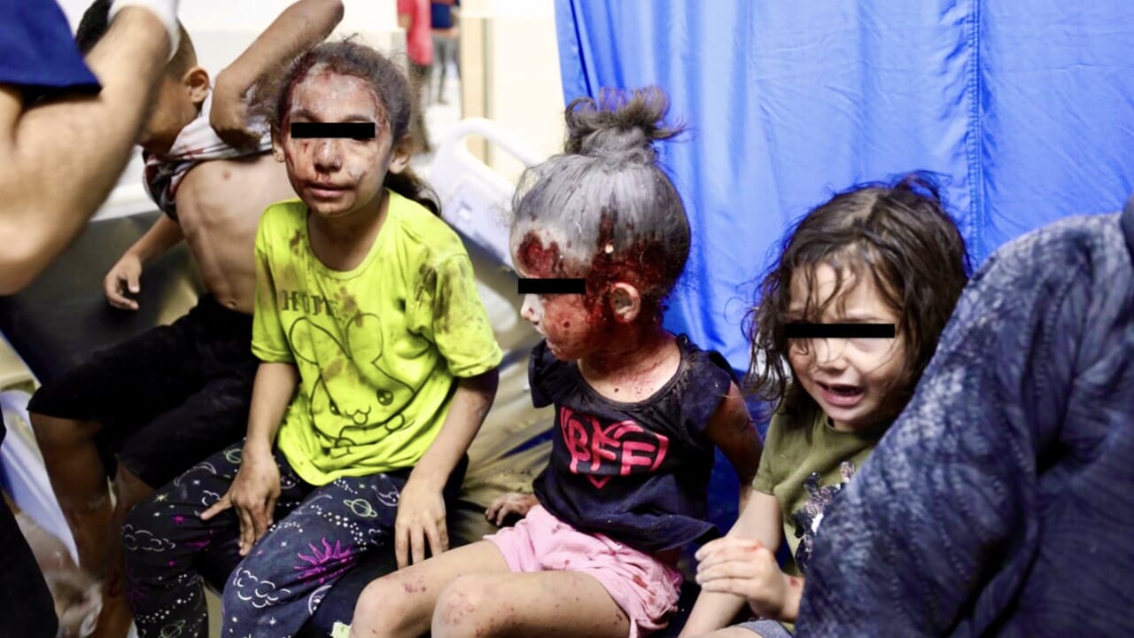 "His brain is protected only by his skin": what Ismail, the Naza child who is waiting to be operated on in Italy, says
